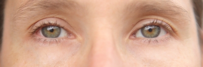 ¿Sabe cómo combatir la enfermedad ocular del momento?