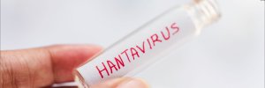 Expertos UDES analizan alerta mundial por hantavirus y explican riesgos para Colombia, s&iacute;ntomas y medidas de prevenci&oacute;n