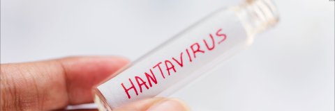 Expertos UDES analizan alerta mundial por hantavirus y explican riesgos para Colombia, síntomas y medidas de prevención