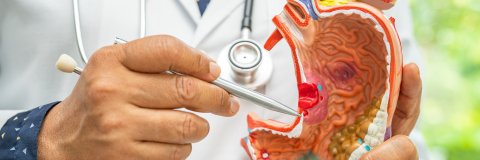 UDES Cúcuta desarrolla estrategia de conocimiento preventivo ante el cáncer gástrico